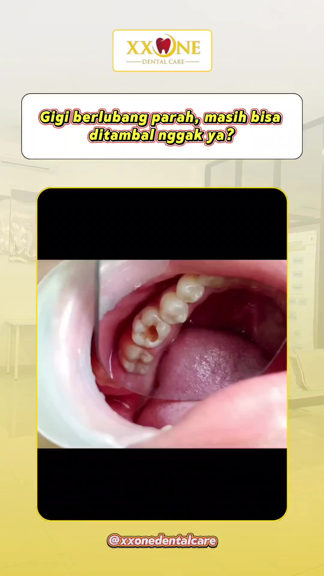 @Dokter Gigi Kota Metro Lampung
