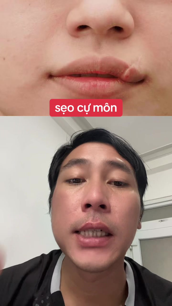 @Tuệ Nhãn ✅
