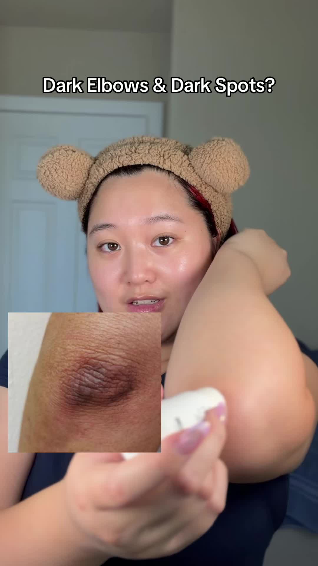 @Korean Skincare | Trish Trinh