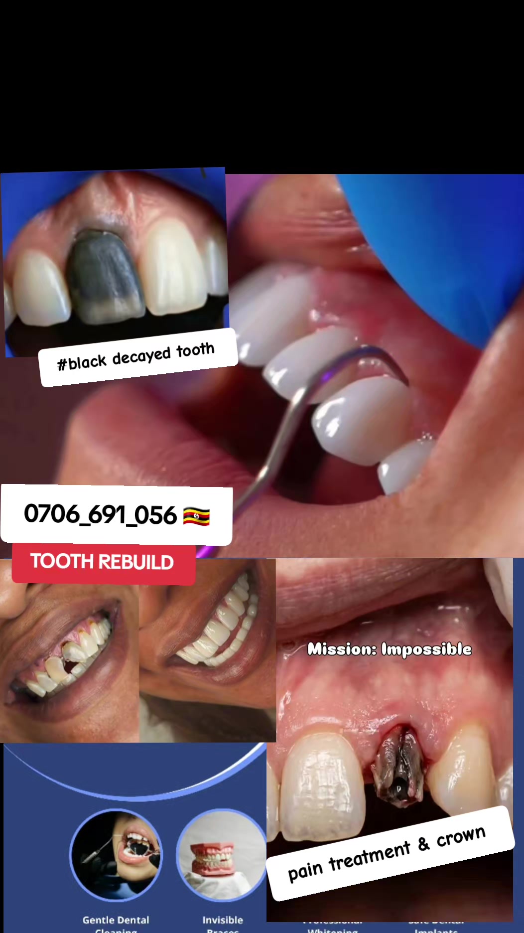 @Dental studio.🦷.Kampala