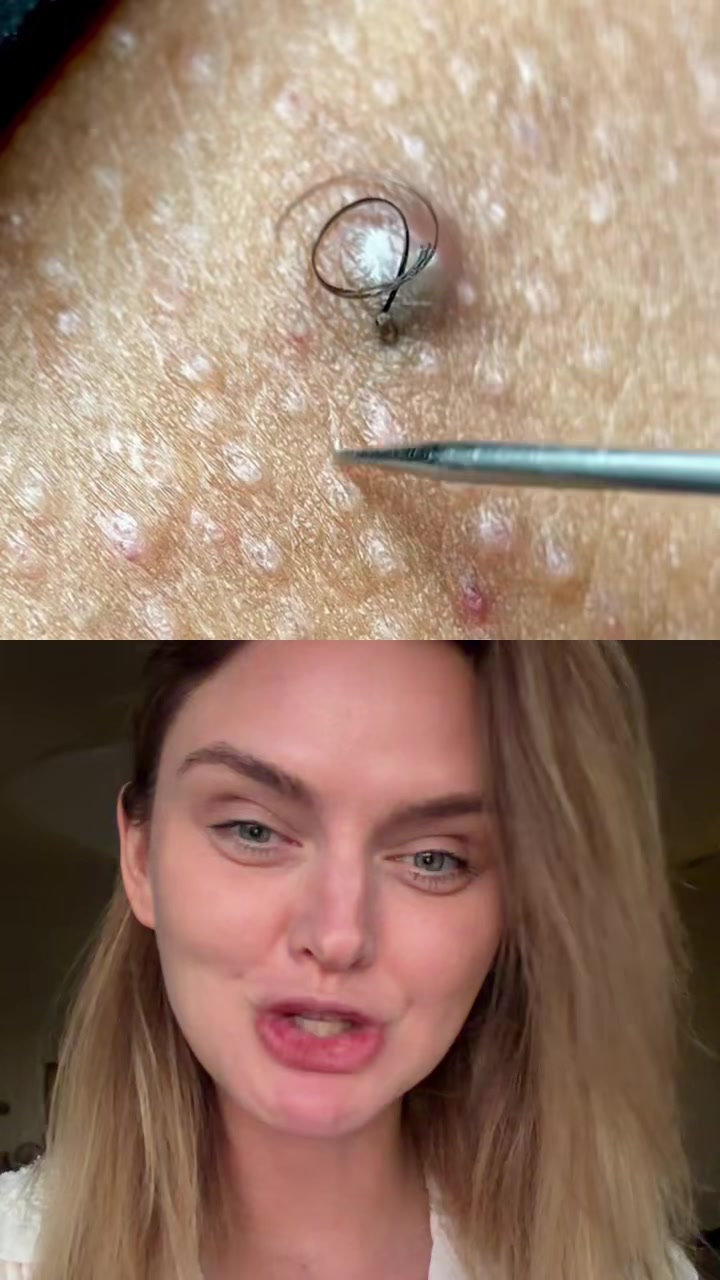 @Dermasophy | Doc. Polner