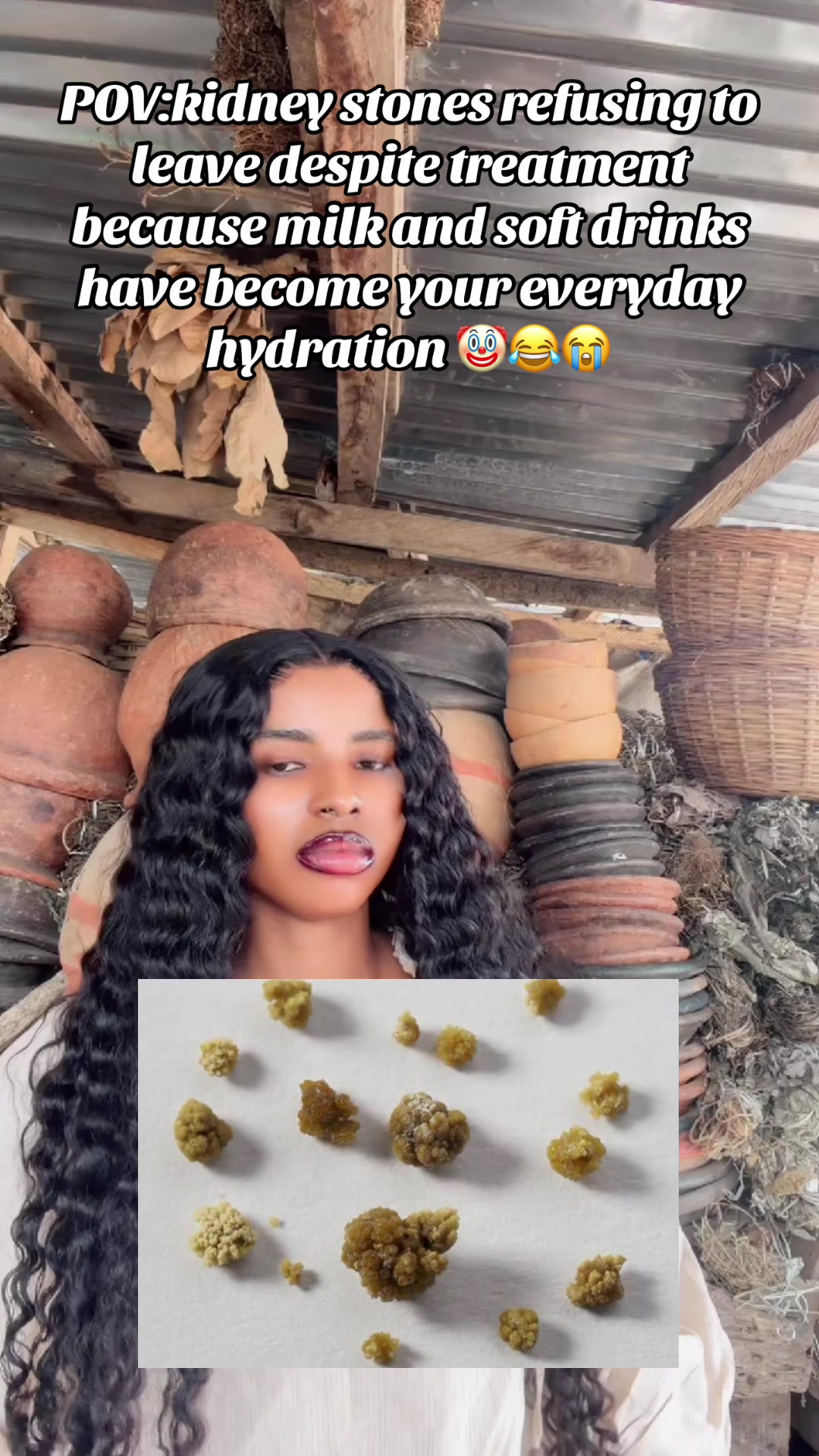 @GeNz_alagbo🐍🍯