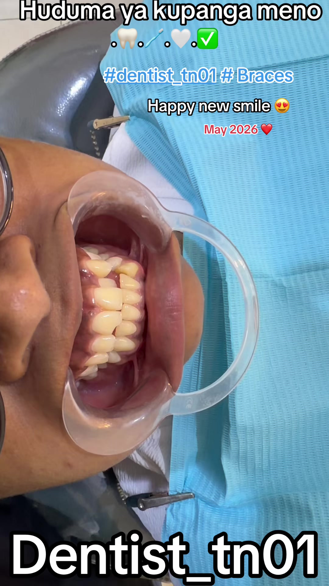 @Dentist_tn01