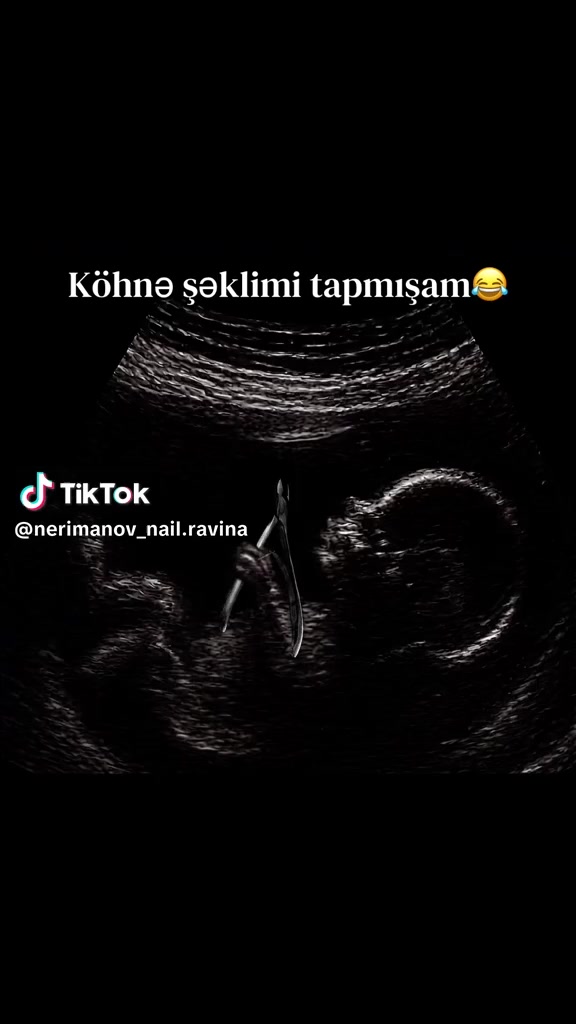 @👑QELBI GÖZEL👑04