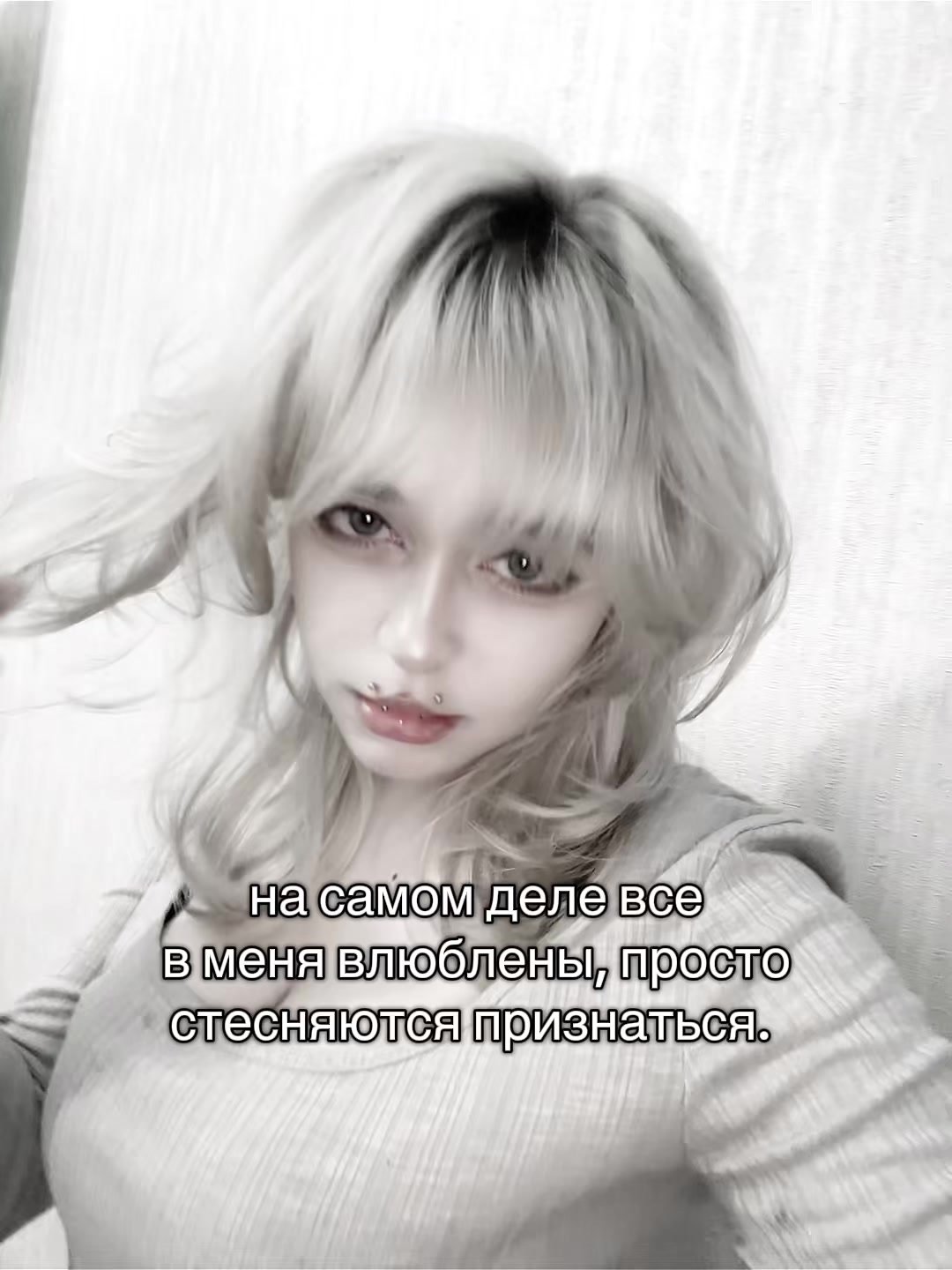 @uglyrosis