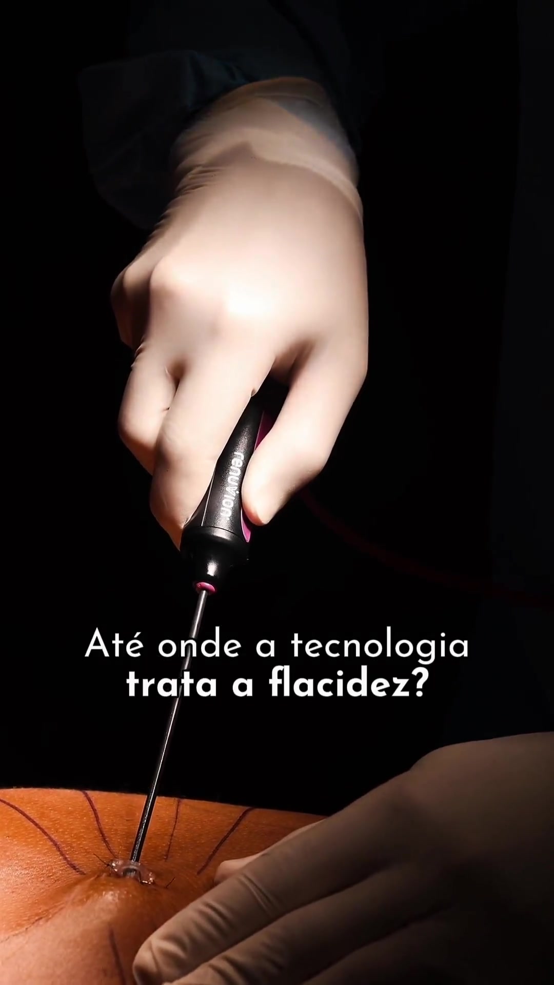 @Fernando Bianco