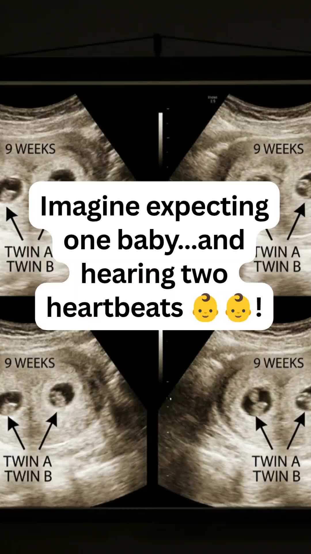 @Nurse Mum Guide