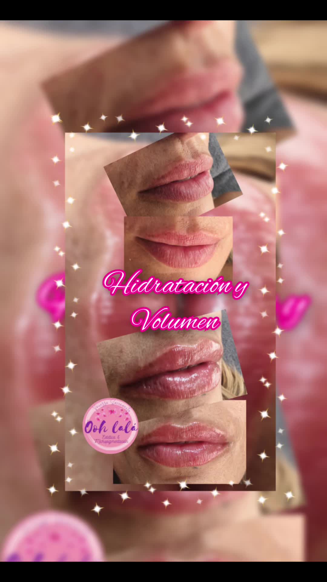 @Oohlal&aacute; Est&eacute;tic