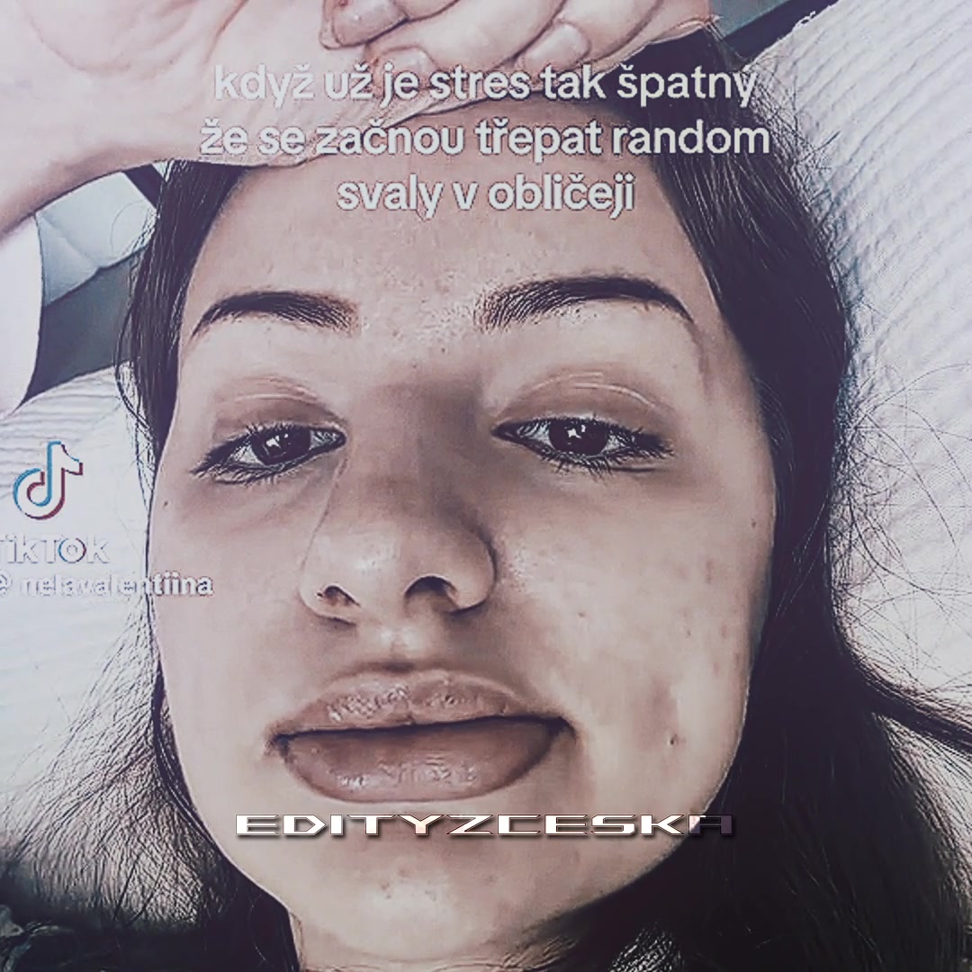 @edityzceska