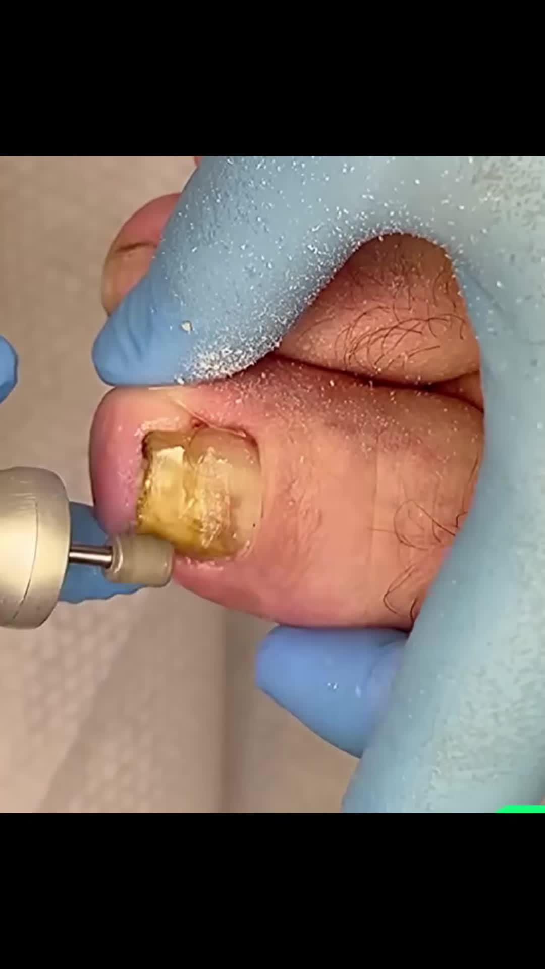 @Toenails.clips