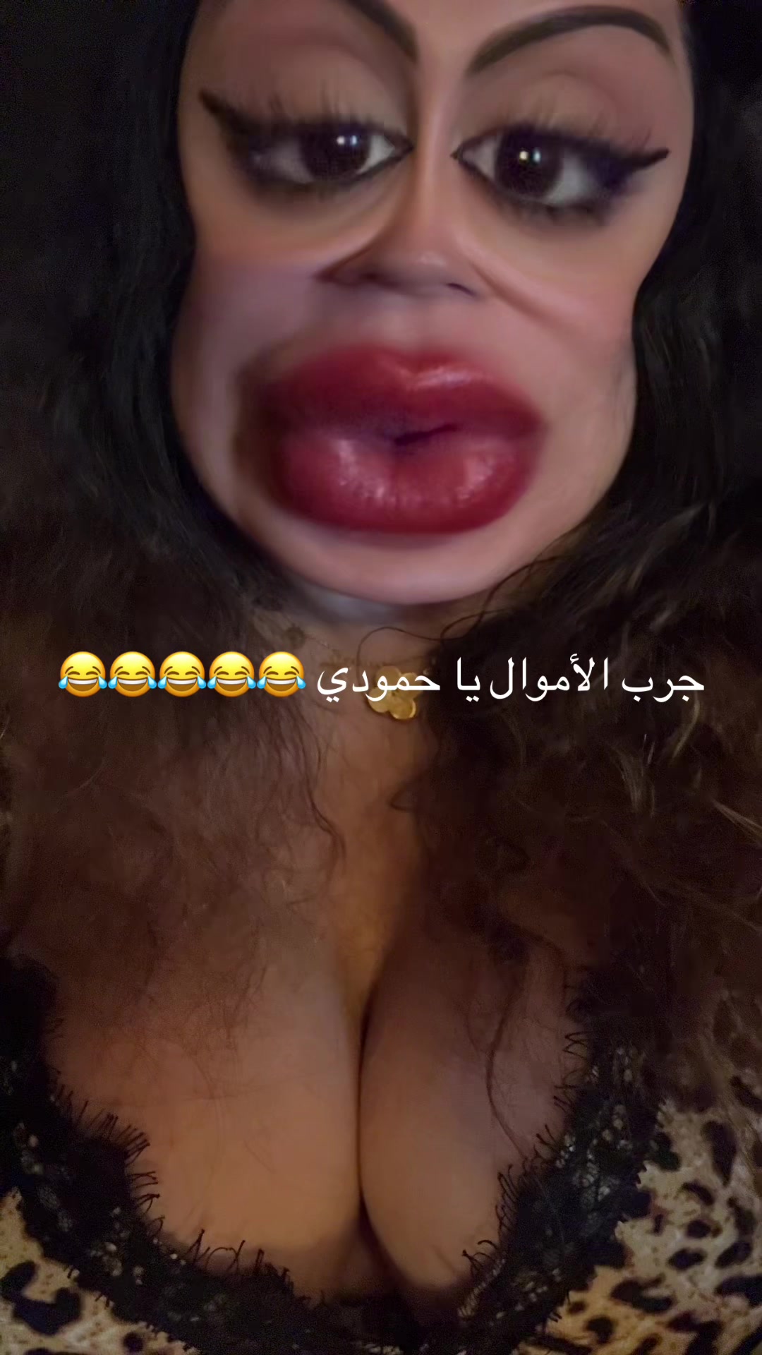@melisa