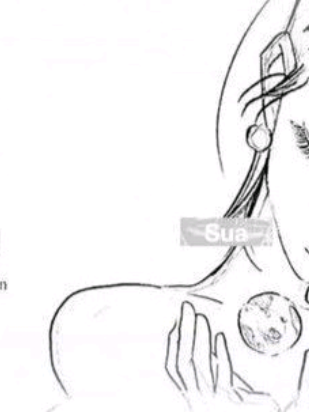 @Ale