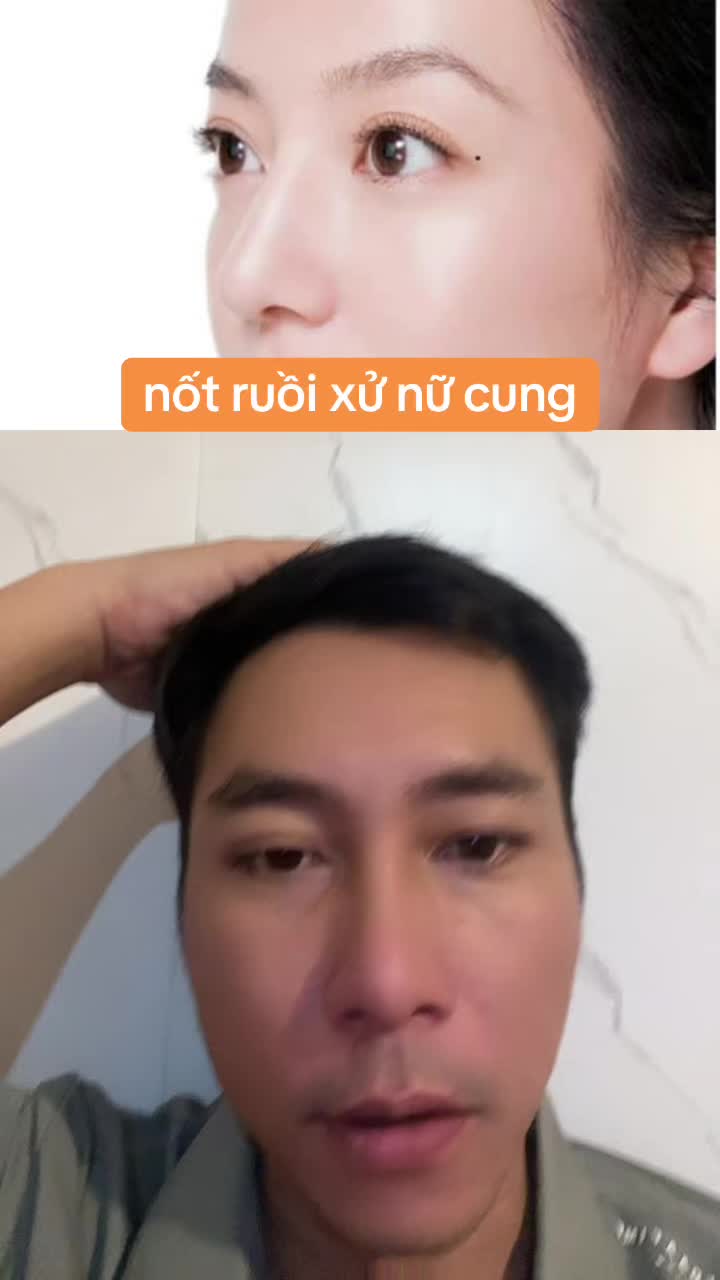 @Tuệ Nhãn ✅