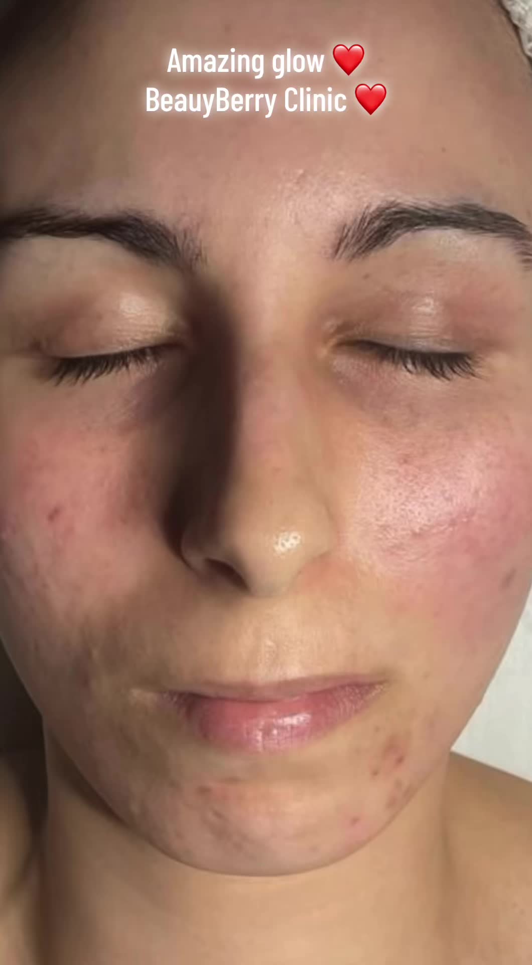 @BeautyBerryClinic_ByJagoda