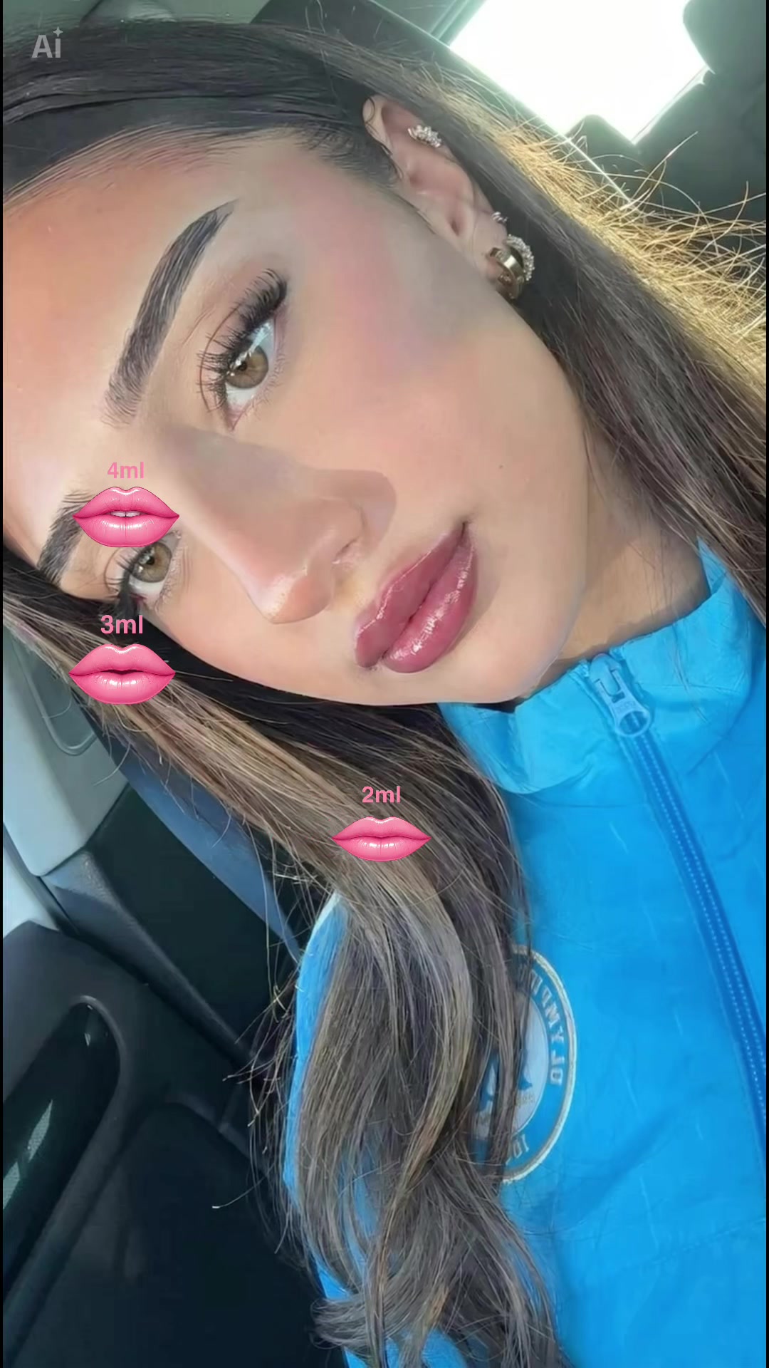 @ʟᴜᴢᴅʟᴜɴᴀ