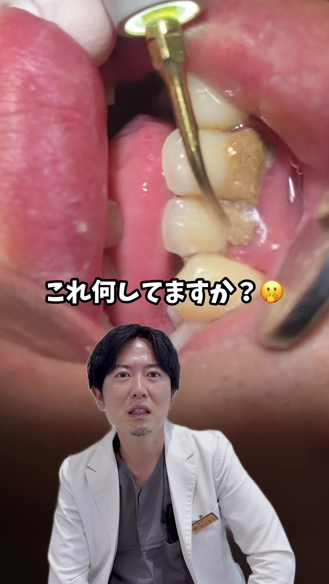 @Dr.山元(湘南歯科クリニック心斎橋院)