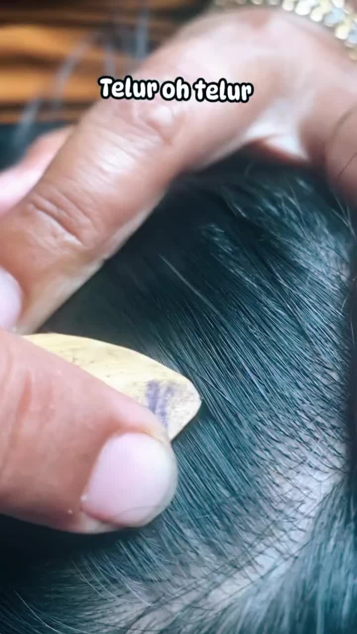@Atieck dulhadi 🪲💇