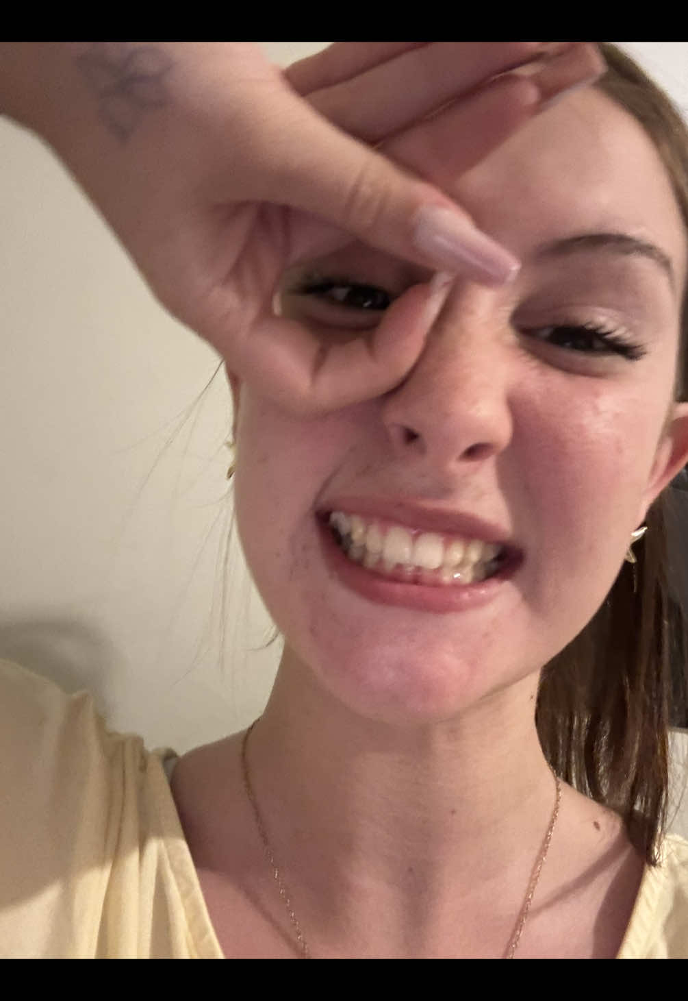 @Albiita