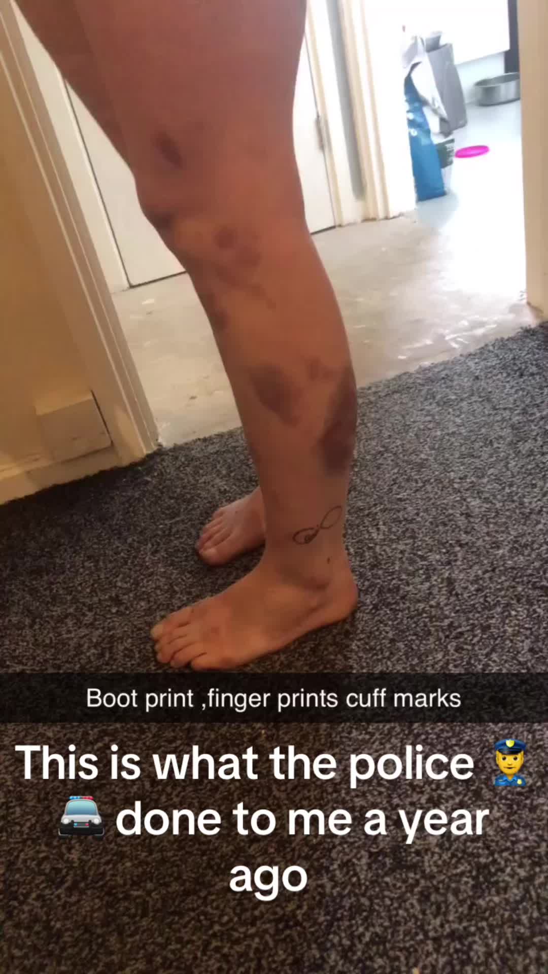 @srs9622