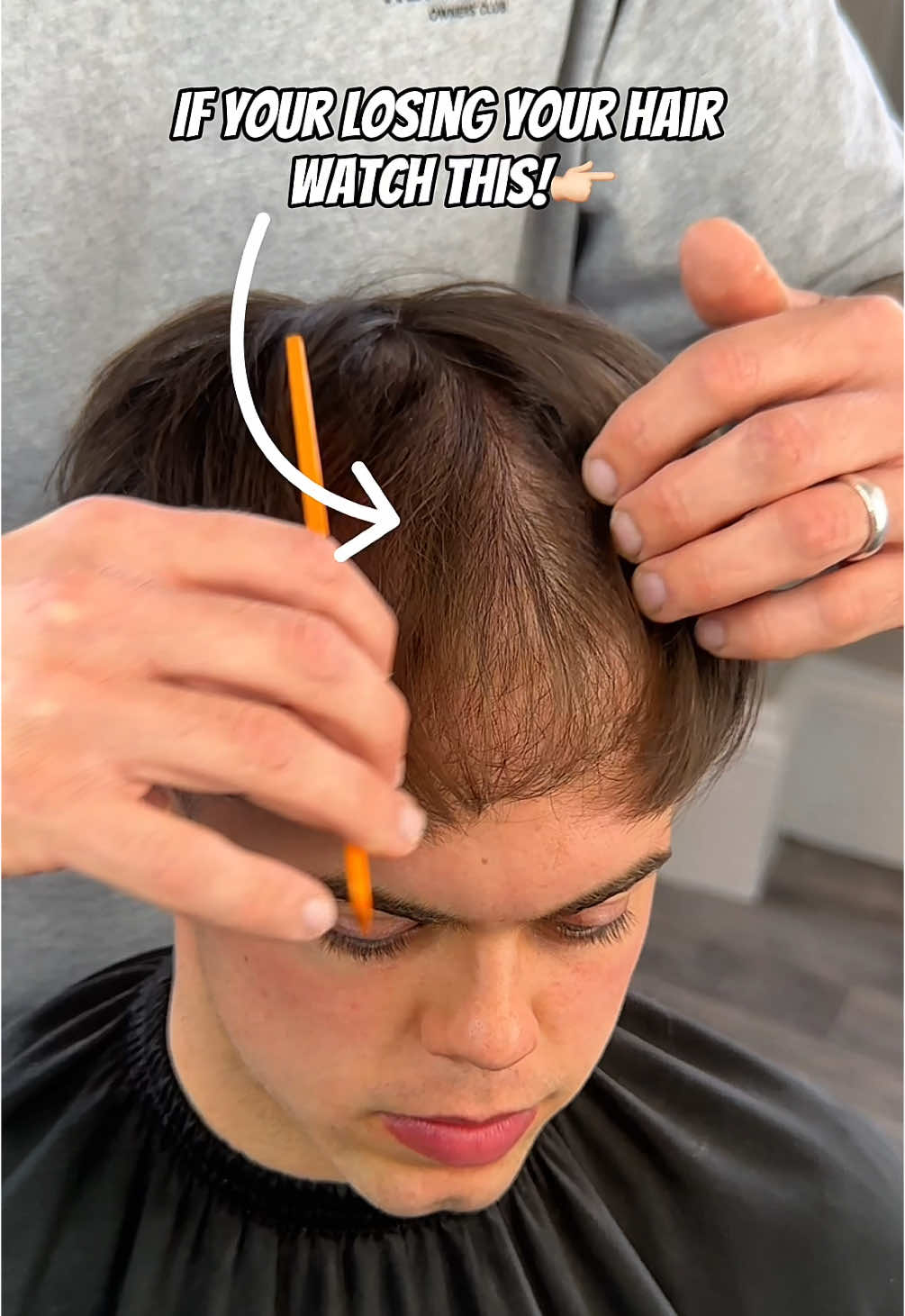 @josh_hair_systems