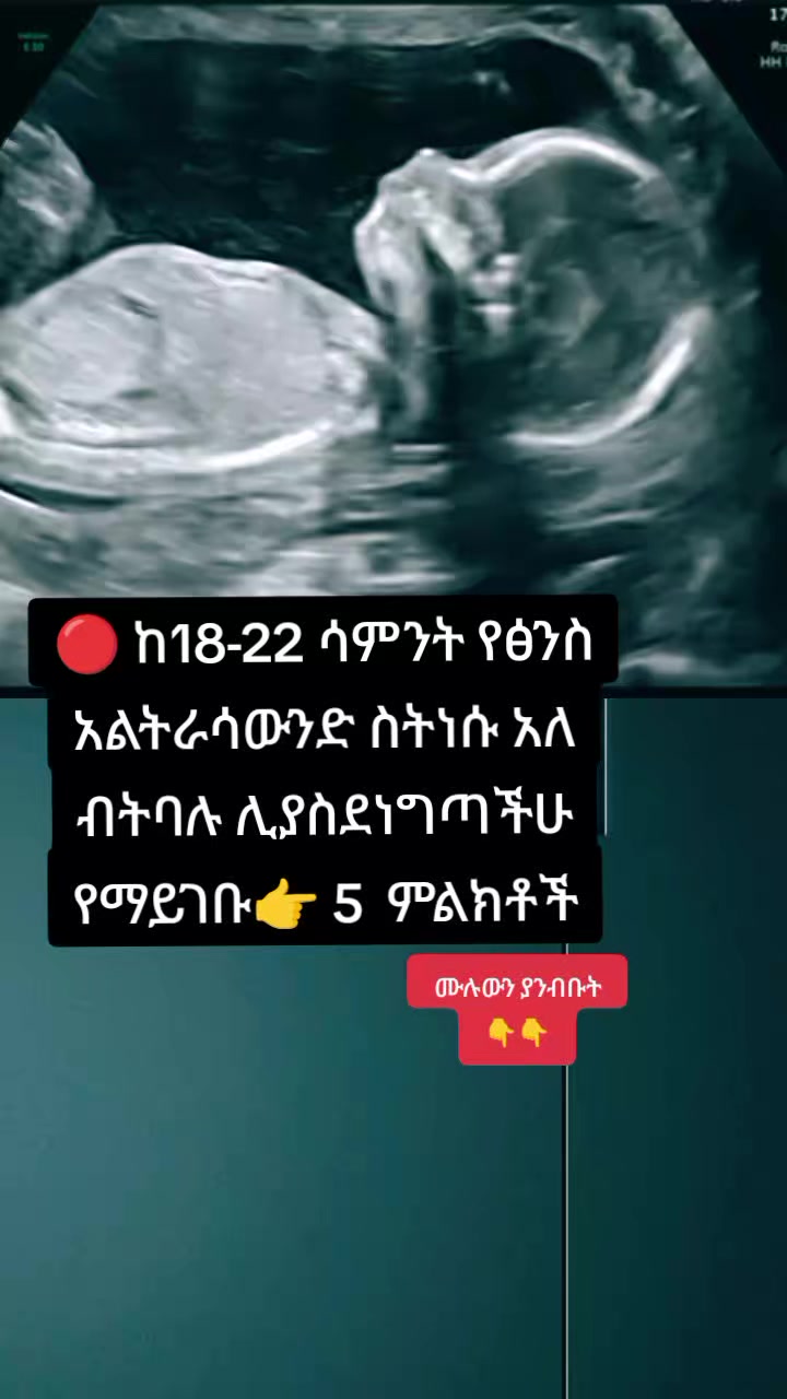 @🩺ዶ/ር ትዕዛዙ (የማህፀን እና ፅንስ ሃኪም)