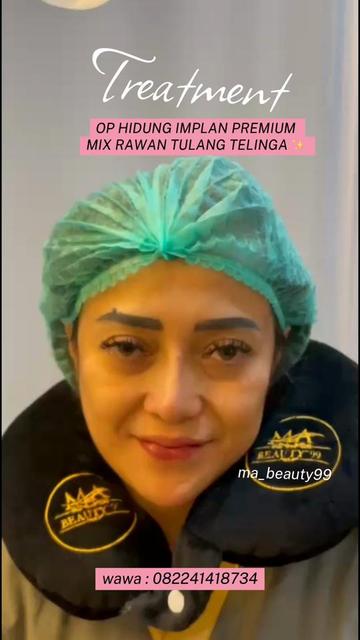 @MA BEAUTY 99