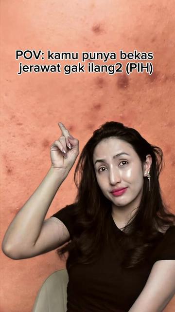 @Nadia Alaydrus