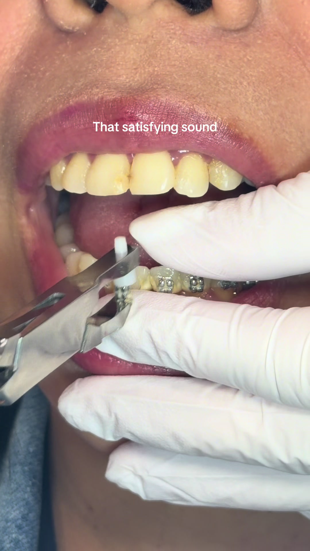 @Hello Dental