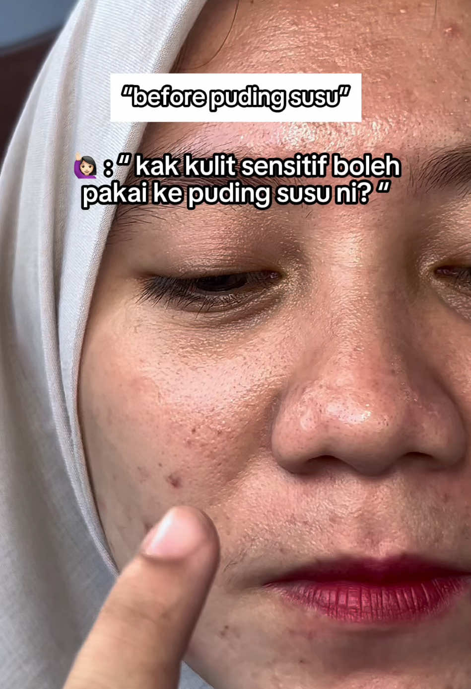@Mervably Skin