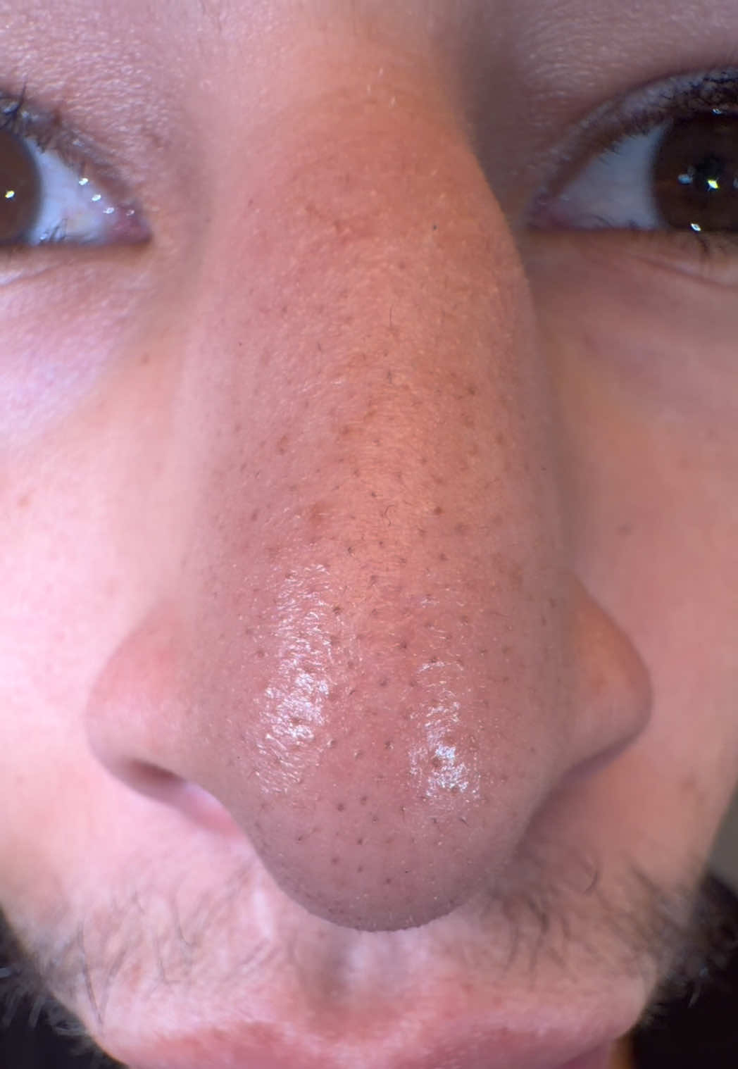 @&hellip;