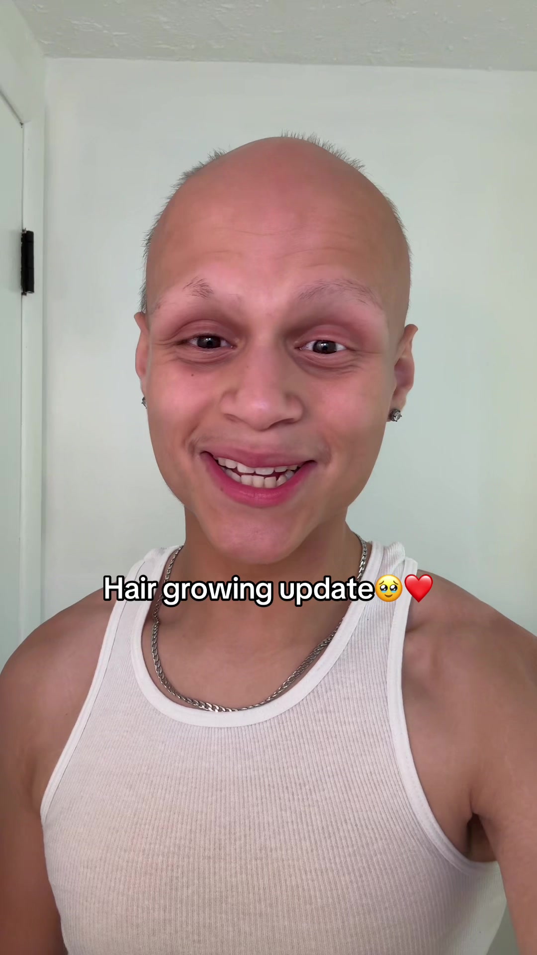 @GxbrielPn