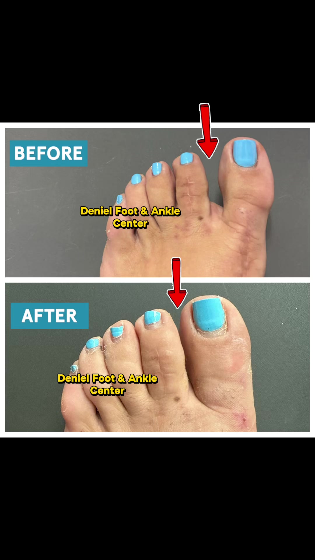 @Deniel Foot and Ankle Center