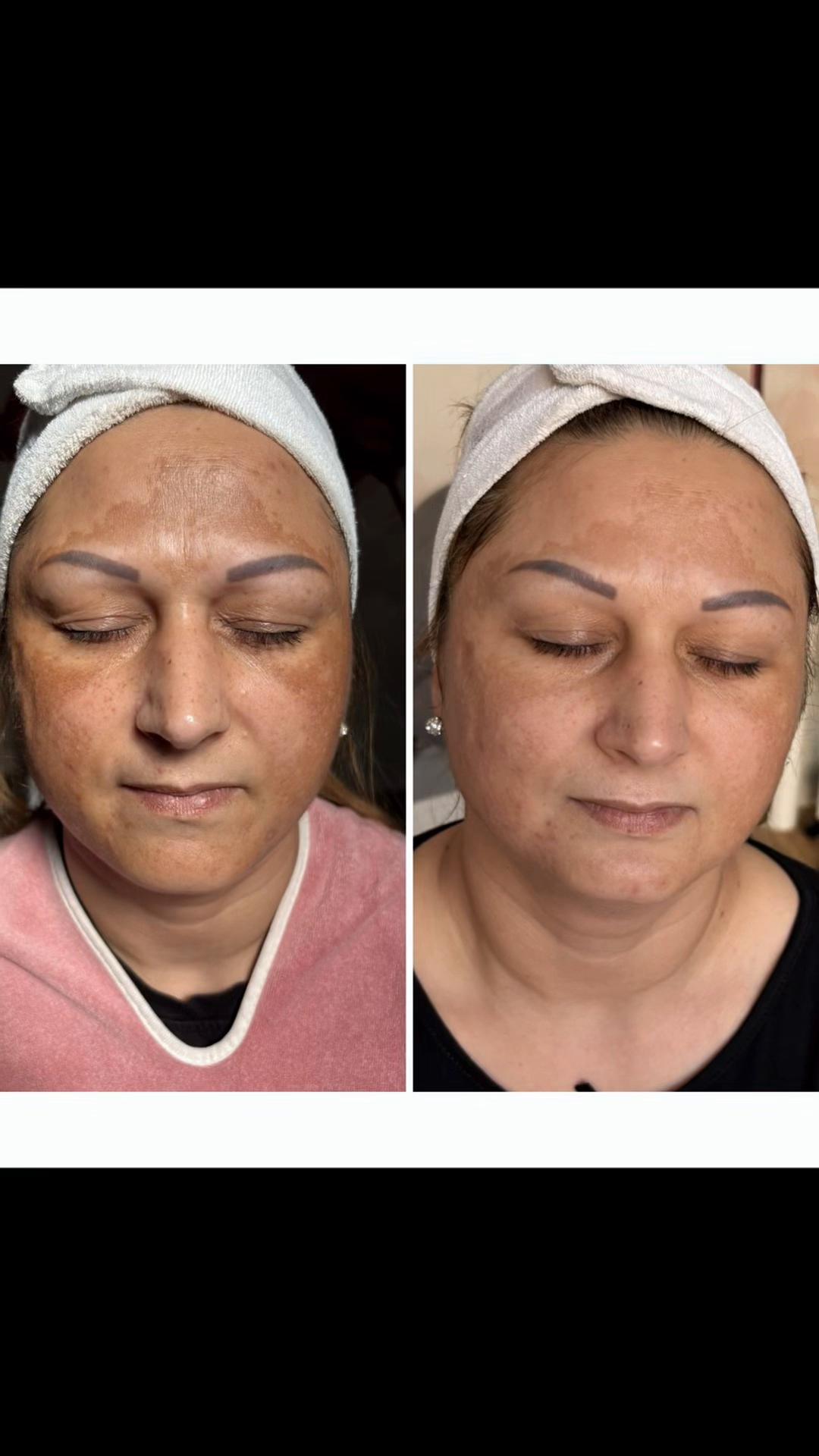 @P&aacute;ll Patr&iacute;cia Bőrterapeuta