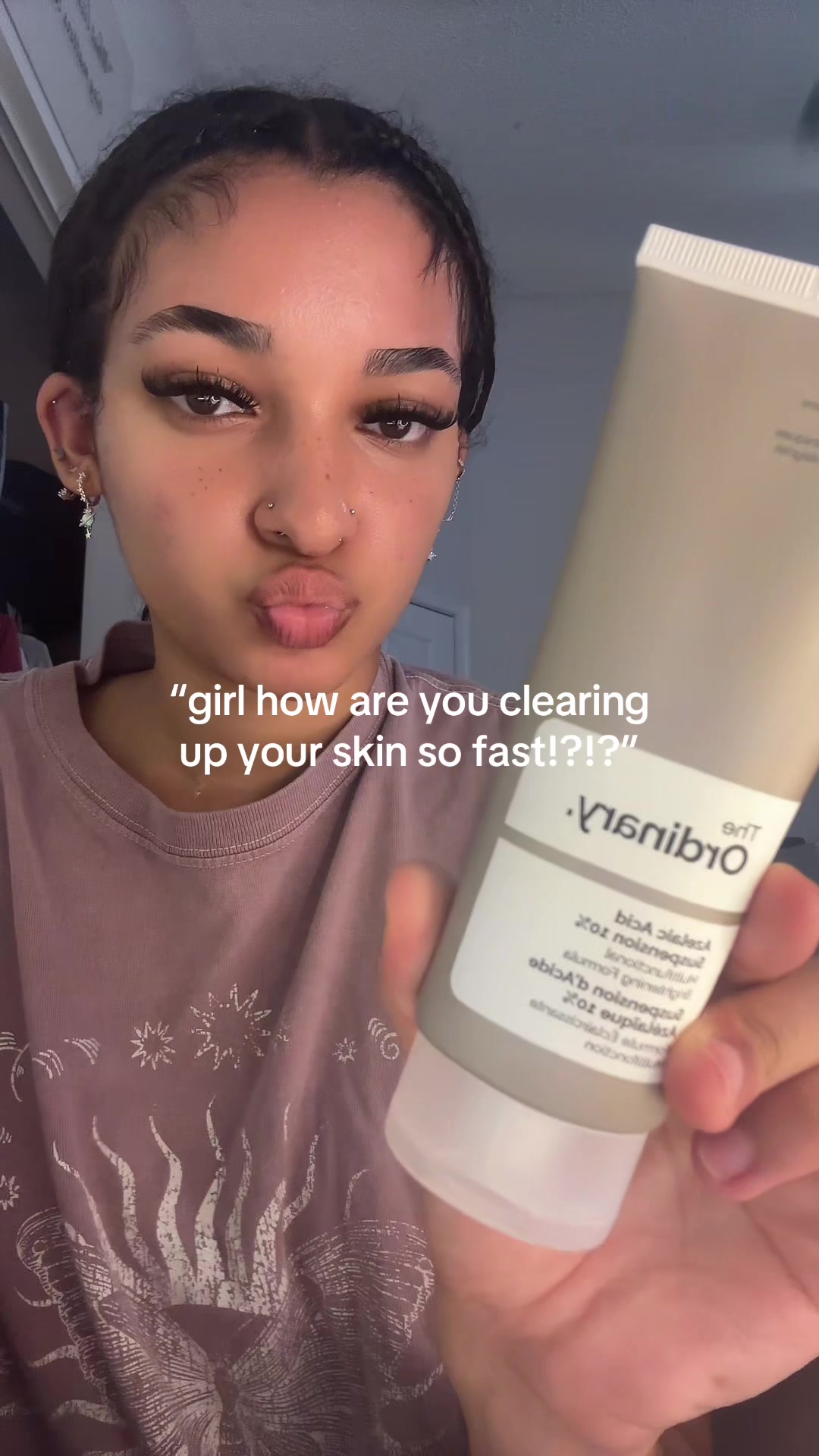 @em