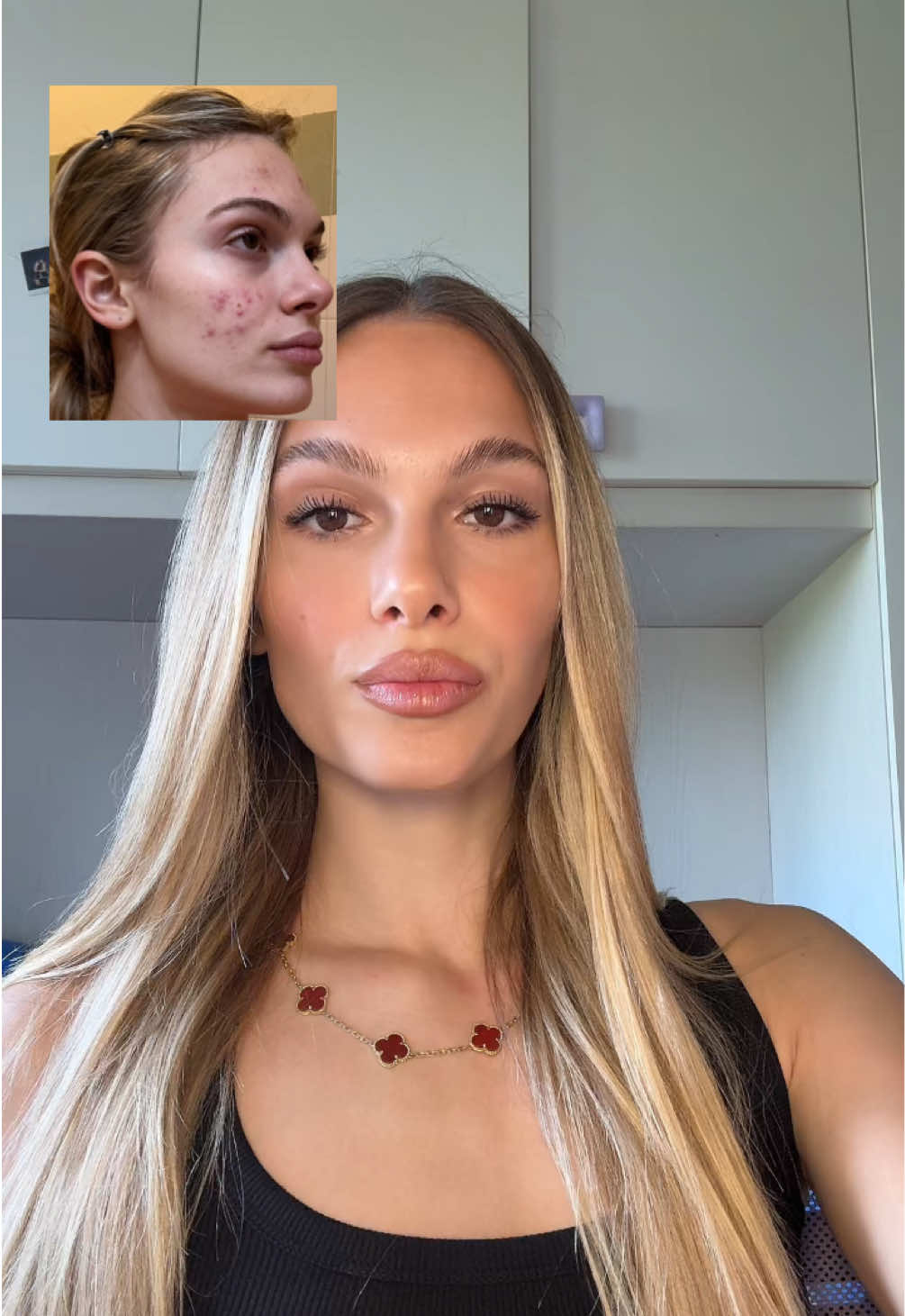 @𝐹𝐸𝐷𝐸𝑅𝐼𝐶𝐴👸🏼
