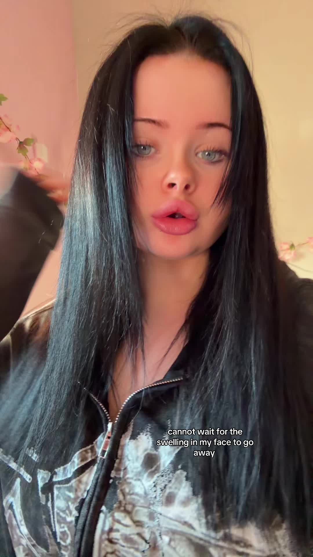 @Zoe