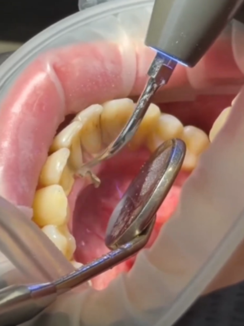 @Tech Dental
