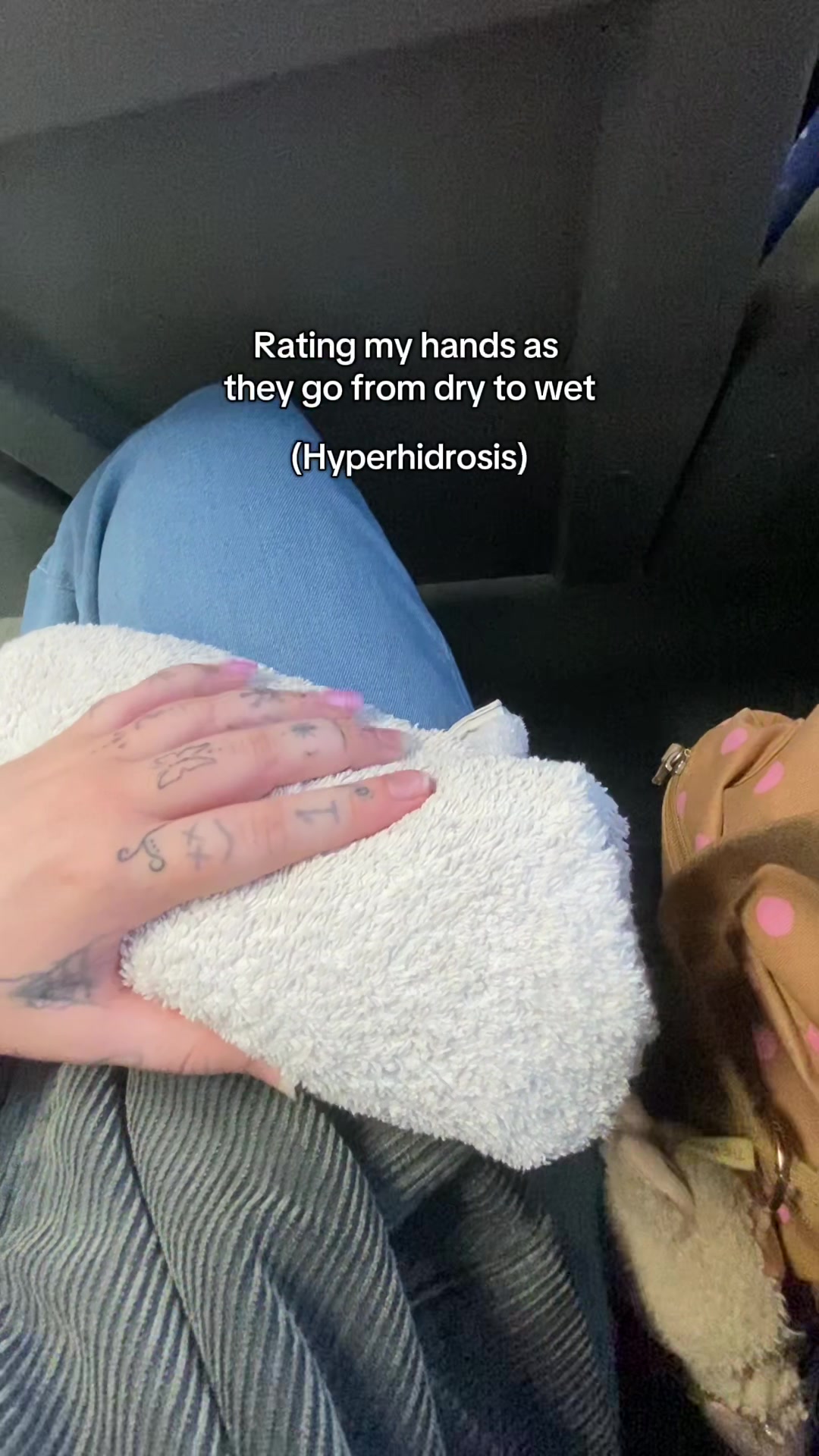 @LivingWithHyperhidrosis