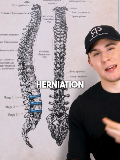 @Recover Pain