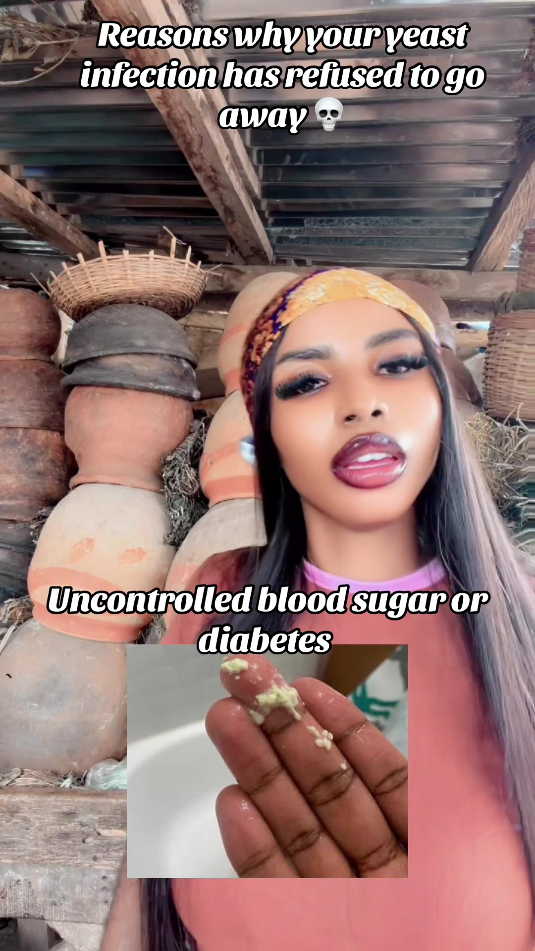 @GeNz_alagbo🐍🍯
