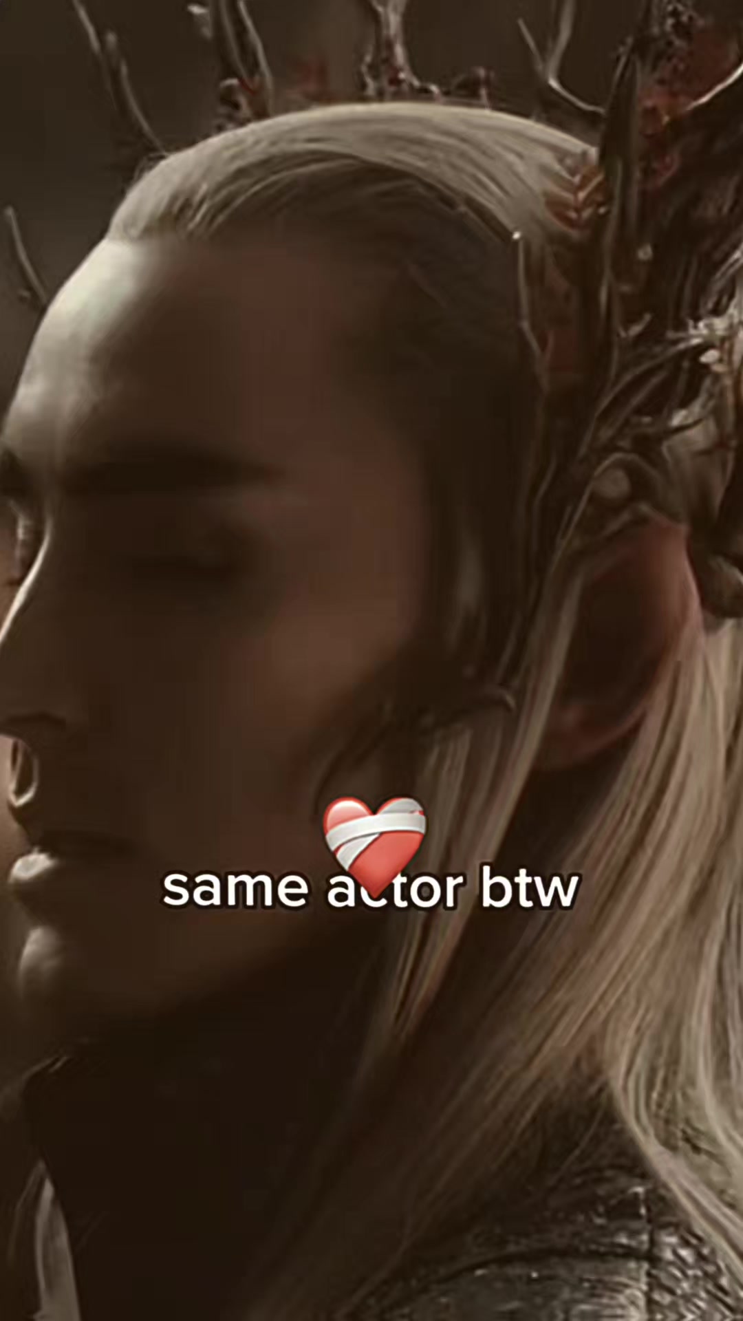 @SAL