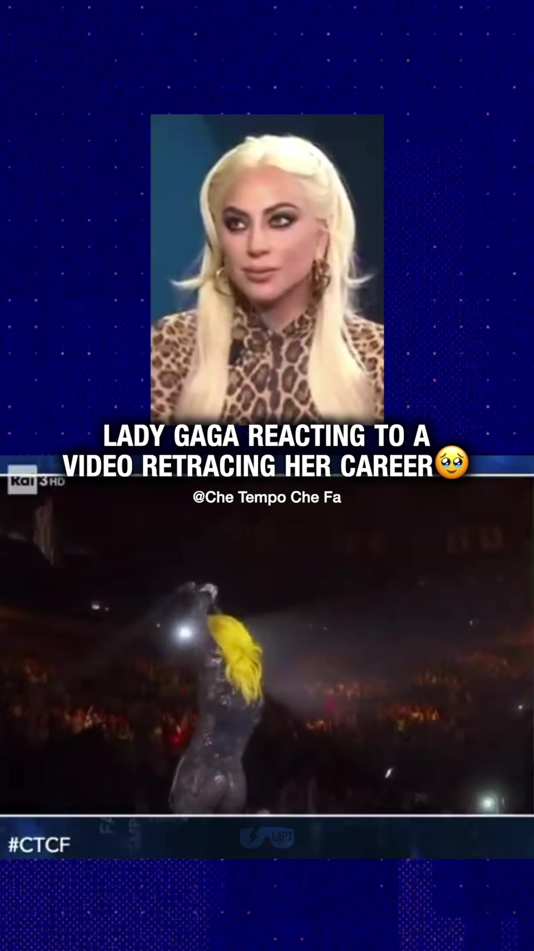 @ladygagabox