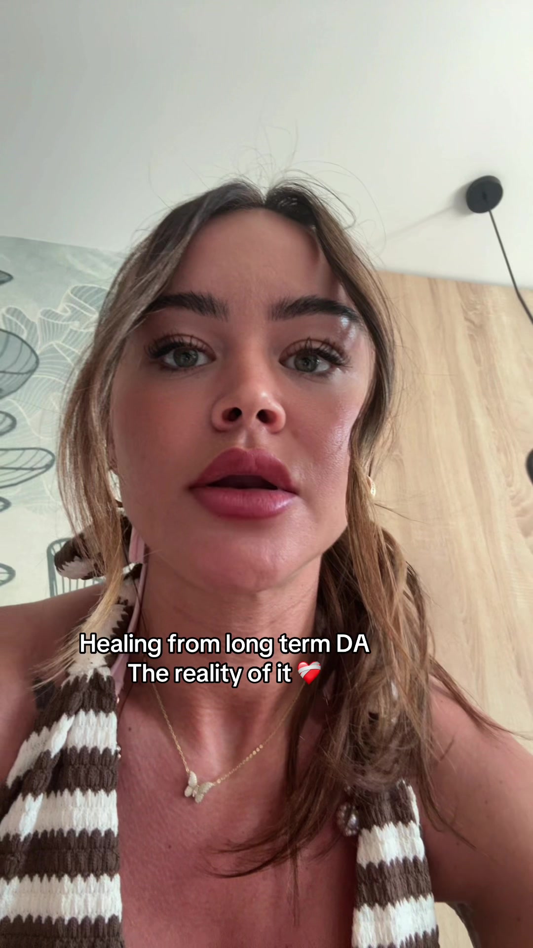 @rheeex
