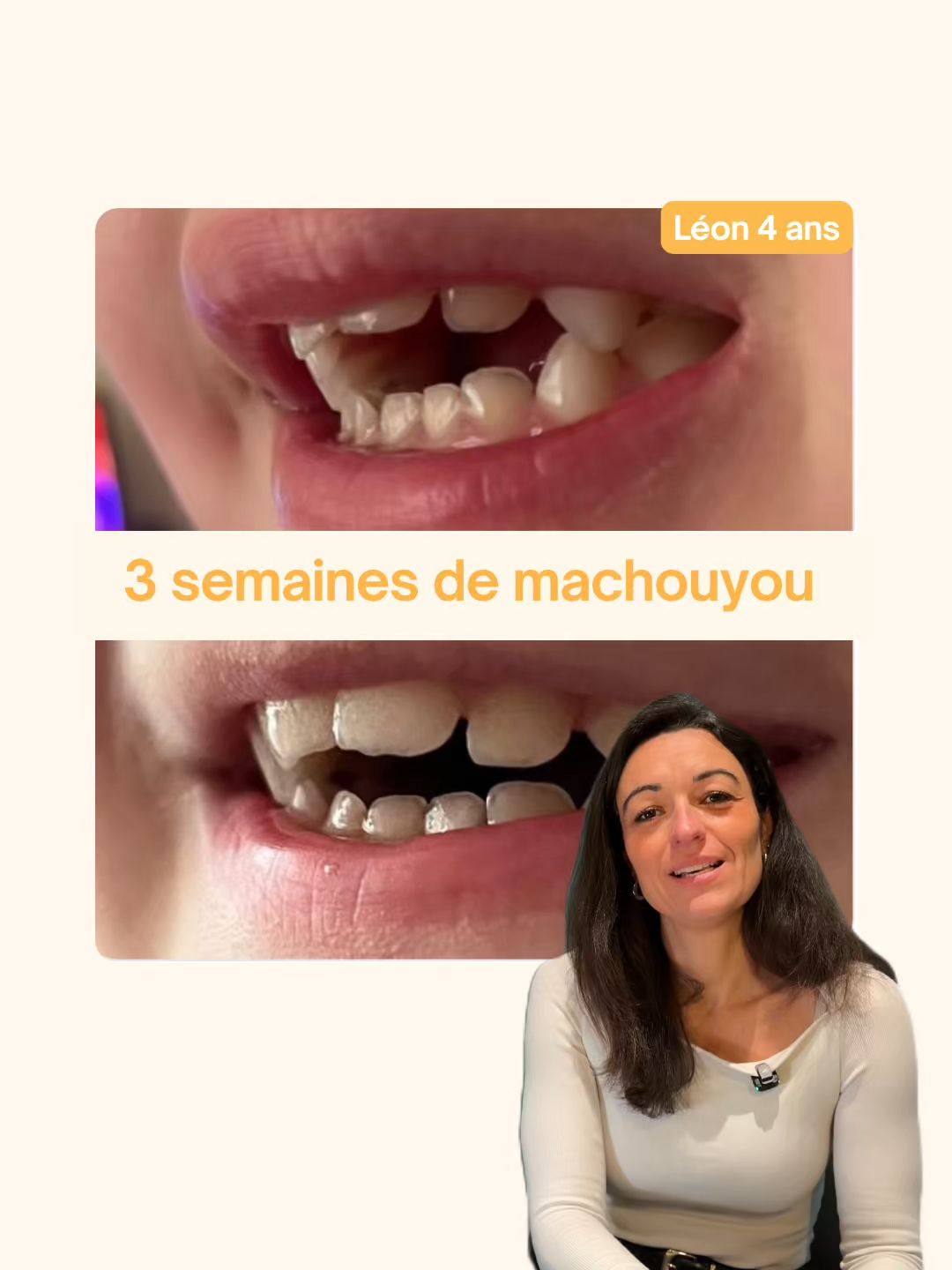 @MACHOUYOU