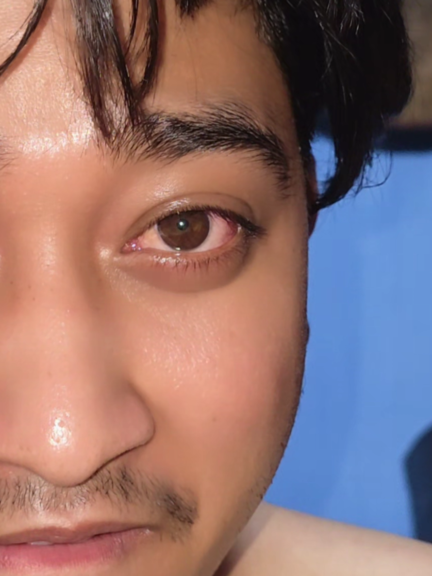 @kiran