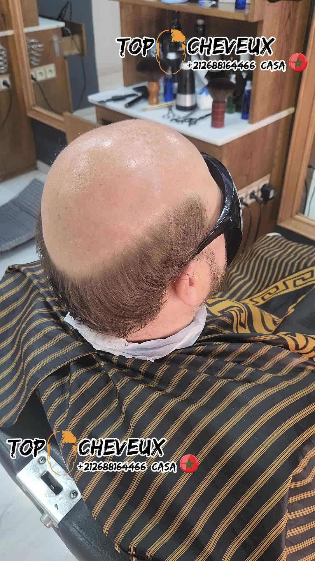 @top cheveux