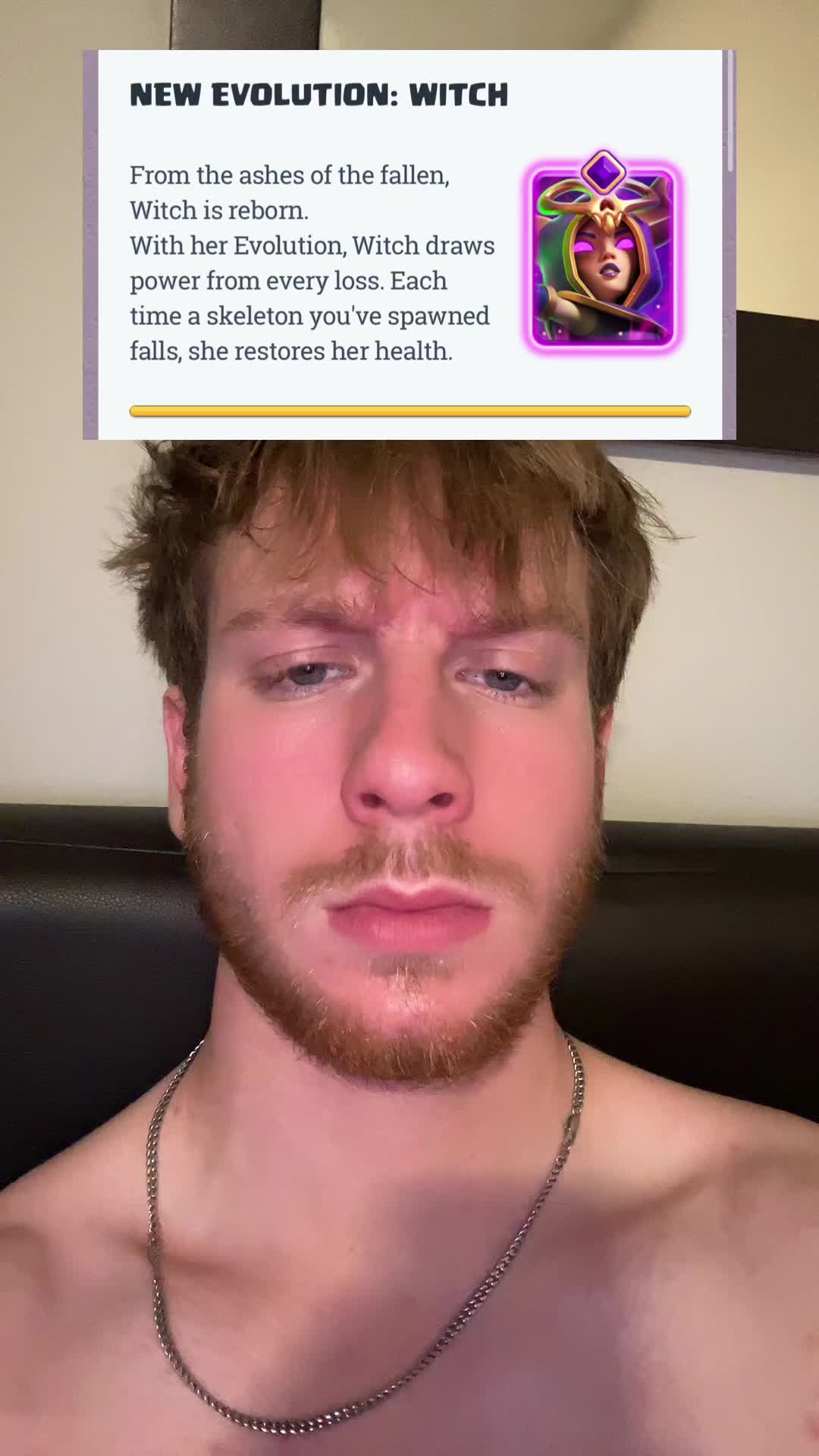@fettion
