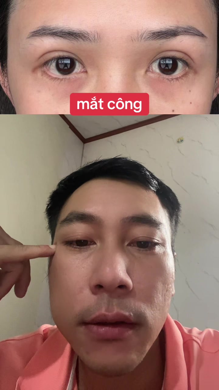 @Tuệ Nhãn ✅