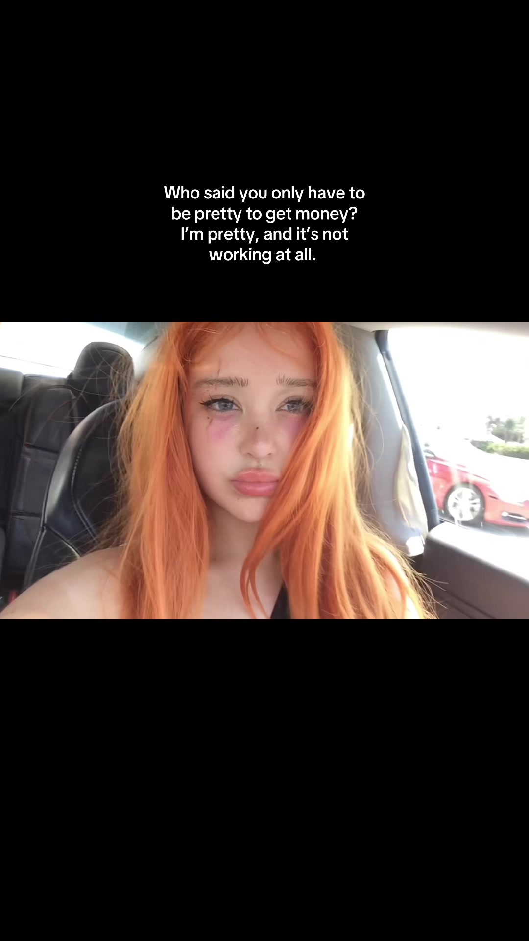 @Anoi