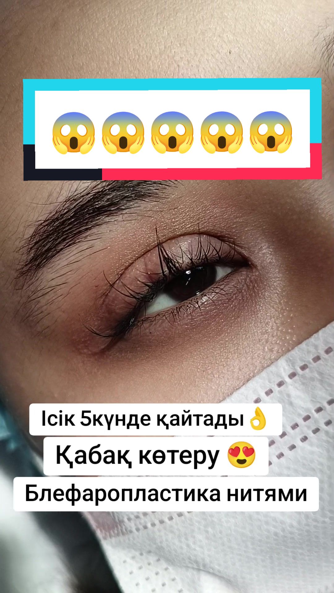 @Стоматология, Блефаро, ПМ 🇰🇿